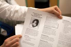 Fetal Alcohol Spectrum Disorder An Epidemic Of Brain Damage