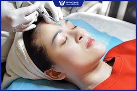 PRP trị sẹo rỗ sẹo lõm có an toàn & hiệu quả không?– Phòng Khám Da Liễu HHV  Clinic