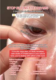 Image result for Eye Acidity Test