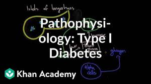 Pathophysiology Type I Diabetes Video Khan Academy