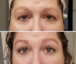 Puffiness Dark Circles And Crow S Feet Can Take A Walk Haar En Schoonheid Haar Schoonheid