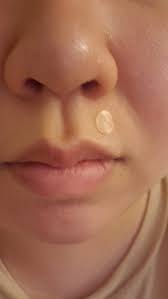 Review Nexcare Blemish Clear Cover Read At Hunnyy Com Kbeauty Nexcare Skincare Blemish Acnesticker Pimple Skin Care Blemishes Top Beauty Products