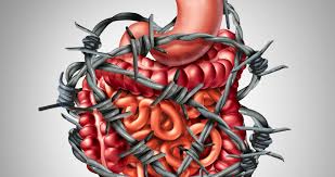 Doctors don't know what causes ibs. The Abc Of Irritable Bowel Syndrome Ibs Genesis Medical