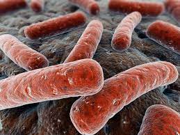 Diff, is a bacterium that can cause symptoms ranging from diarrhea to. Clostridium Difficile Diagnostik Im Stuhl Medizinisches Versorgungszentrum Labor Dr Klein Dr Schmitt Gmbh