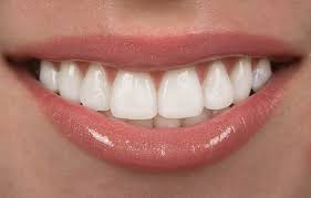 Put your tongue on the roof of your mouth. Cosmetic Restoration Ramadentalcare