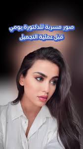 ‫صور مسربة لـ يومي قبل التجميل: صدمة الجمهور | TikTok‬‎