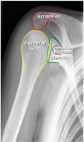 X Schouder Startradiology In 2020 Radiology Imaging Human Anatomy And Physiology Medical Anatomy