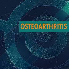 Paul lam, a family physician in sydney, australia. Treatment Of Osteoarthritis With Complementary And Alternative Medicine The Arthritis Connection