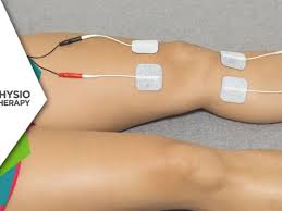 Image result for Electrical Stimulation Therapy