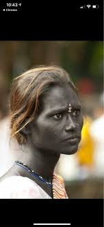 Can a human being have a naturally charcoal-black skin (color)?