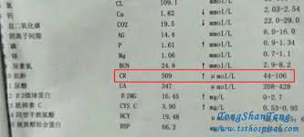Kidney Failure With High Creatinine Level 509umol L No Dialysis Kidney Failure Treatment Kidney Failure Creatinine Levels