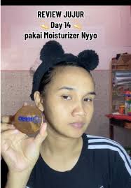 Review Jujur Moisturizer NYYO: Melembabkan Kulit & Meredakan Jerawat