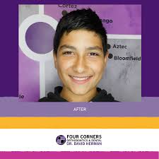 I love my new smile because it looks good for my sports pictures. Everyone  at Dr. Herman's office is nice and friendly!" -Abel Abel is from  Bloomfield, New Mexico and plays football
