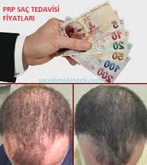 Prp Sac Tedavisi Fiyatlari Mytimeplus Net