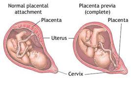 Implantation and development of the placenta: 18 42 Week Scan Ultrasound To Determine Placental Location Ultrasound Care
