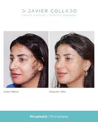 Doctor Javier Collado added a new...