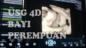 Jika bayi anda perempuan, ovarium mulai menghasilkan jutaan sel telur pada minggu ini. Usg 4d Bayi Perempuan Youtube