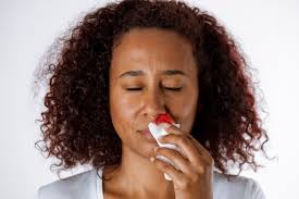 Nosebleeds Treatment Denver