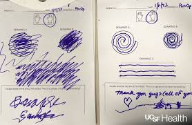 Image result for Essential Tremor