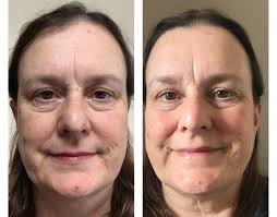 RESULTS! Julie Angel TESTIMONIALS