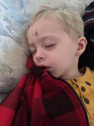 Help for one month old baby constipation?