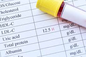 Satirapoj b., supasyndh o., chaiprasert a. Want To Lower Uric Acid Read This Before Buying Cherries Gene Food