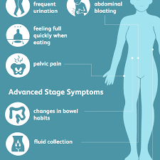 Even when there are signs, it's common for primary care. Ovarian Cancer Signs Symptoms And Complications