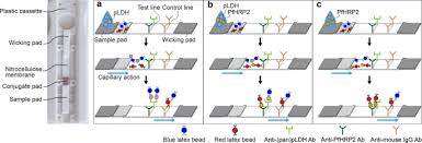 What is a covid lateral flow test? A Two Colour Multiplexed Lateral Flow Immunoassay System To Differentially Detect Human Malaria Species On A Single Test Line Malaria Journal Full Text