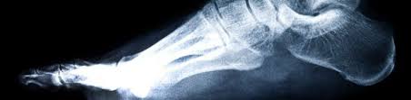 Interestingly the dorsal foot muscles generally have no insertion at the little toe. 10 Fun Feet Facts A Step Ahead Podiatry
