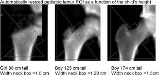 Our reports cover every category imaginable! Asbmr 26th Annual Meeting M001 M585 2004 Journal Of Bone And Mineral Research Wiley Online Library