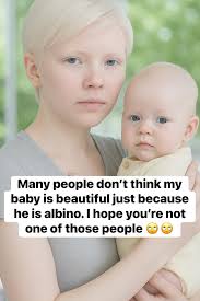 Sometimes the world only sees differences. Some people look at my baby and  say he's not beautiful, just because he was born albino. But when I hold  him in my arms, I