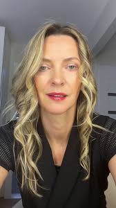 Great training with great people, ✅ Nail fungus removal, ✅skin rejuvenation  , ✅pigment removal, ✅facial veins, ✅roseaca, ✅cherry angioma, ✅laser hair  removal