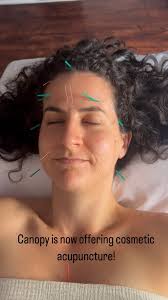Canopy Healing Center is now offering Cosmetic Acupuncture with the amazing  Jet Eveleth! Enjoy a natural way to reduce wrinkles, brighten the skin and  improve the overall appearance of your face!