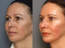 Epingle Sur Astuces Beaute