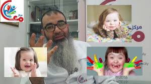 تصنيفات اخرى لمتلازمة داون Down Syndrome من المهم معرفتها مع اسامة م Oly Home Decor Decor
