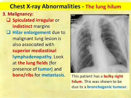 Chest X Ray Fundamentals X Ray Human Anatomy And Physiology Fundamental
