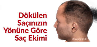 Sac Ekimi Sac Ekim Saglik