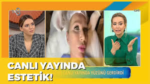 Seda Sayan Yuzunu Gerdirdi Gel Konusalim 383 Bolum Youtube