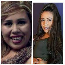 We did not find results for: Asi Luce Despues De Muchas Cirugias Yina Calderon Fotogaleria Radio Los40 Colombia