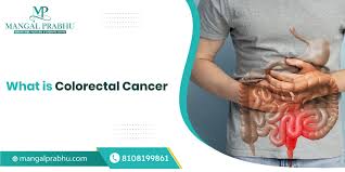 Image result for Colorectal Cancer
