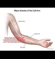Arteries Of Left Arm Vascular Ultrasound Brachial Arteries