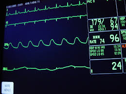 This tool can handle the most common sensor chips, can read modern. Monitoring Your App S Health With Sickbay And The Nurse By Igor Marques Da Silva Medium