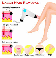 Laser hair removal is also less painful than other hair removal methods. Laser Hair Removal Singapore Arium Clinic Medical Aesthetics