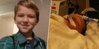 Bocah autis 10 tahun dianiaya dan dibakar teman sepermainan