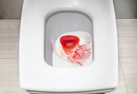 Bagaimana cara menyembuhkan kencing berdarah? Ketahui Penyebab Kencing Berdarah Yang Anda Alami Honestdocs