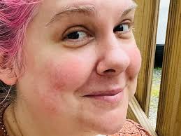 Fundraiser by Sarah Erdo : Support Sarah's Battle with Chronic Illness