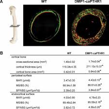 A cross section of a human long bone. Activation Of Pthr1 Signaling In Osteocytes Increases Periosteal And Download Scientific Diagram
