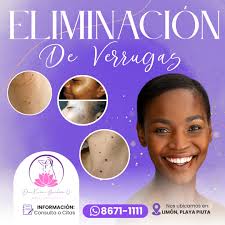 𝙀𝙡𝙞𝙢𝙞𝙣𝙖𝙘𝙞𝙤́𝙣 𝙙𝙚 𝙑𝙚𝙧𝙧𝙪𝙜𝙖𝙨 🌴🏥𝗡𝗼𝘀 𝘂𝗯𝗶𝗰𝗮𝗺𝗼𝘀  𝗲𝗻 𝗟𝗶𝗺𝗼́𝗻 𝗖𝗲𝗻𝘁𝗿𝗼, 𝗲𝗻 𝗣𝗶𝘂𝘁𝗮⁣ 𝗣𝗮𝗿𝗮 𝗺𝗮́𝘀  𝗶𝗻𝗳𝗼𝗿𝗺𝗮𝗰𝗶𝗼́𝗻, 𝗱𝗮𝗹𝗲 𝗰𝗹𝗶𝗰𝗸 𝗮𝗹 𝗲𝗻𝗹𝗮𝗰𝗲:  https://wa.link/mrwrv5