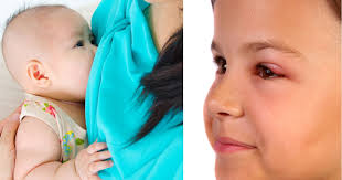 Dengan minum teh halia, ia dapat membuang angin. Awas Bila Bayi Kembung Perut Mama Papa Kena Tahu Punca Dan Cara Redakan Pa Ma
