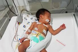 Mengapa bayi yang baru terlahir ke dunia selalu menangis ? Lahir Prematur Dan Menderita Sindrom Gagal Napas Bayi Ibu Susilawati Membutuhkan Bantuanmu